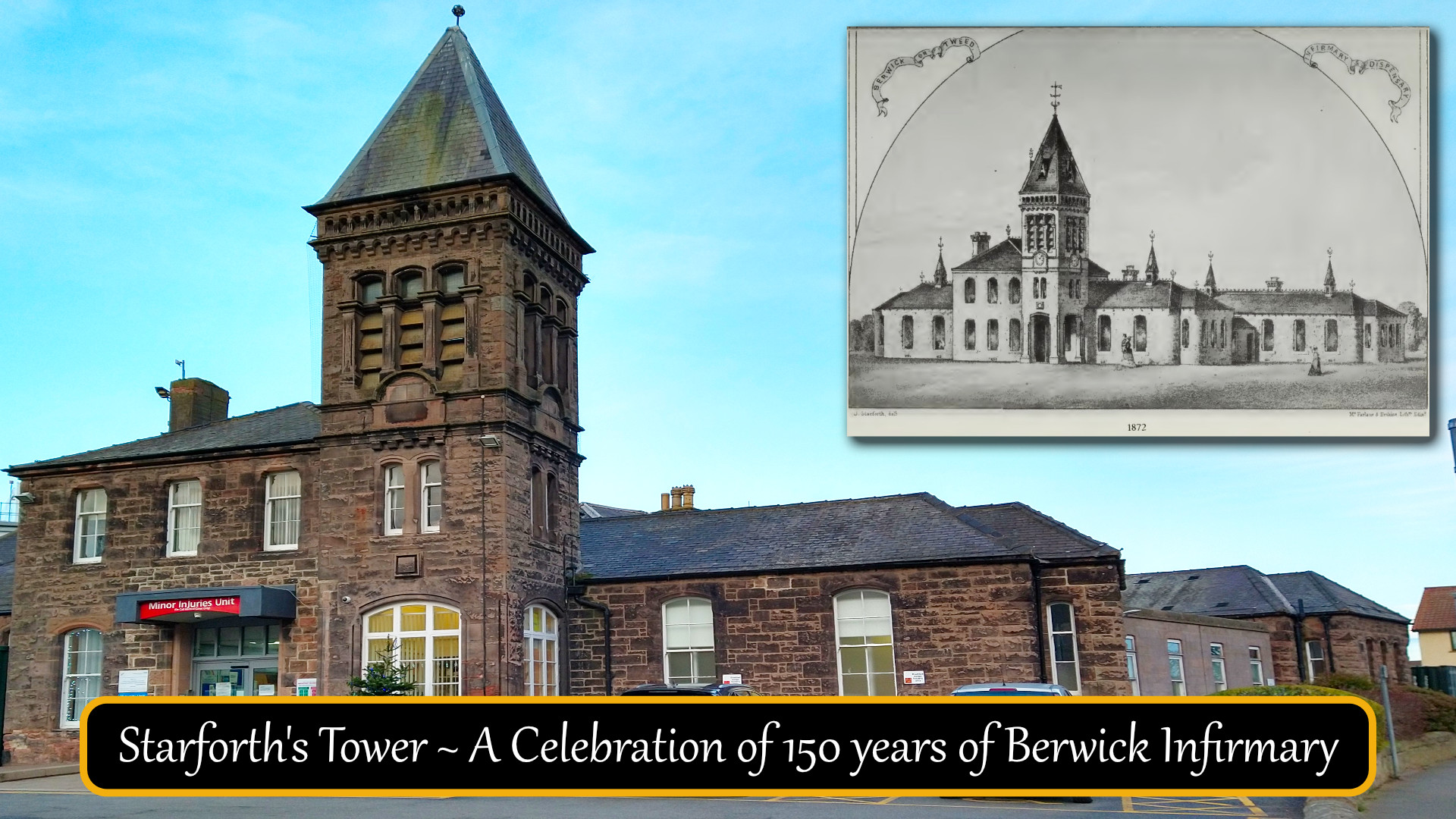 Starforth's Tower