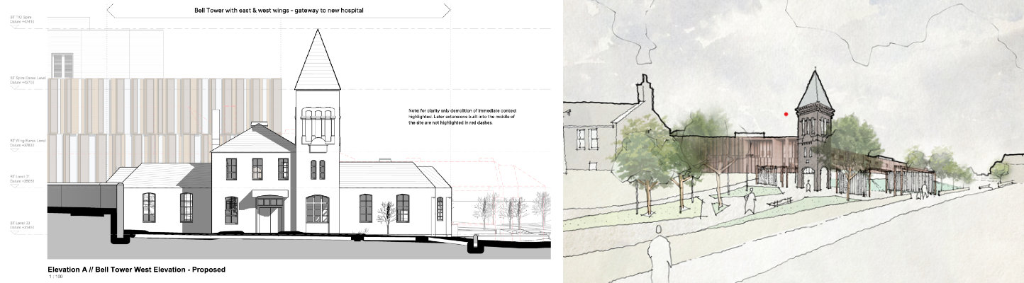 Infirmary plans before and after